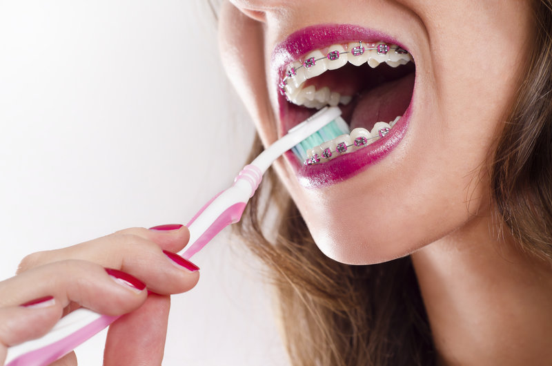 7 Dental and Health Risks of Crooked Teeth